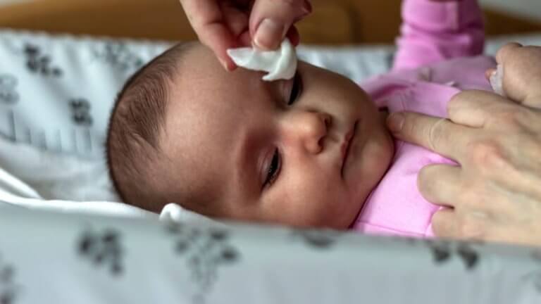 Conjuntivite em bebê: sintomas e tratamentos